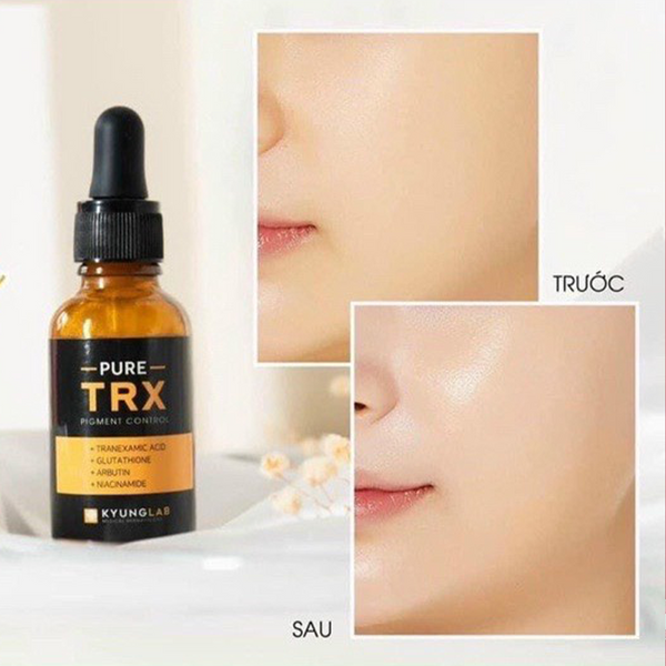 Serum trị nám tàn nhang Kyung Lab TRX 30ml